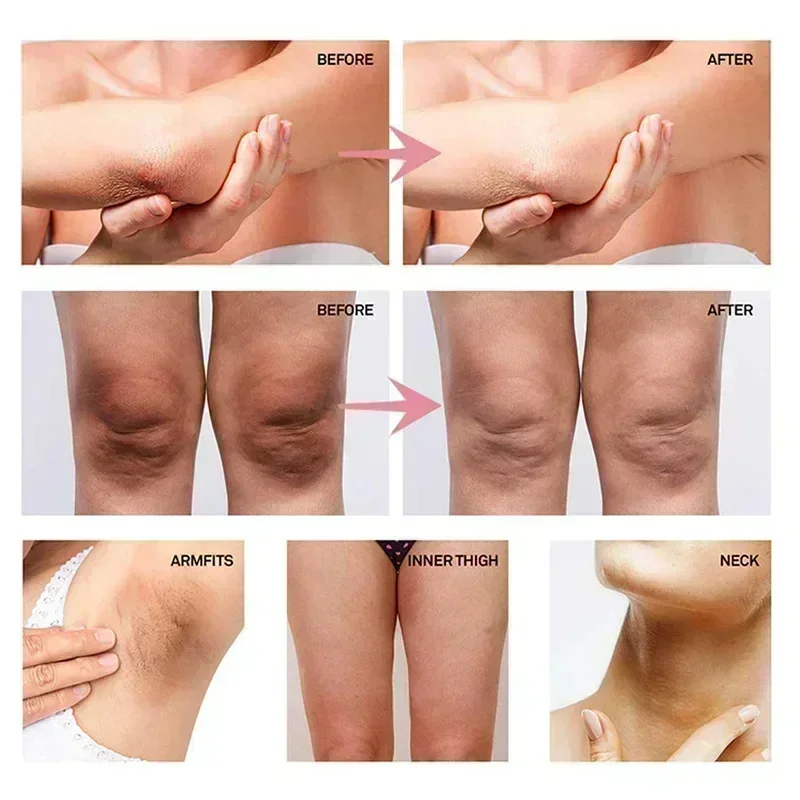 Collagen Underarm Whitening Cr - огляд і ціна Skincare Collagen
