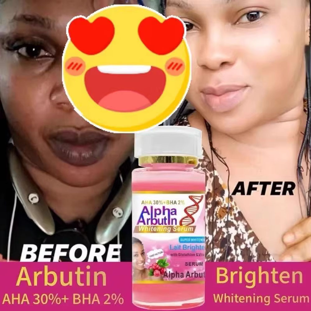 Alpha Arbutin Serum AHA 30%+ B - огляд і ціна Alpha Arbutin Serum