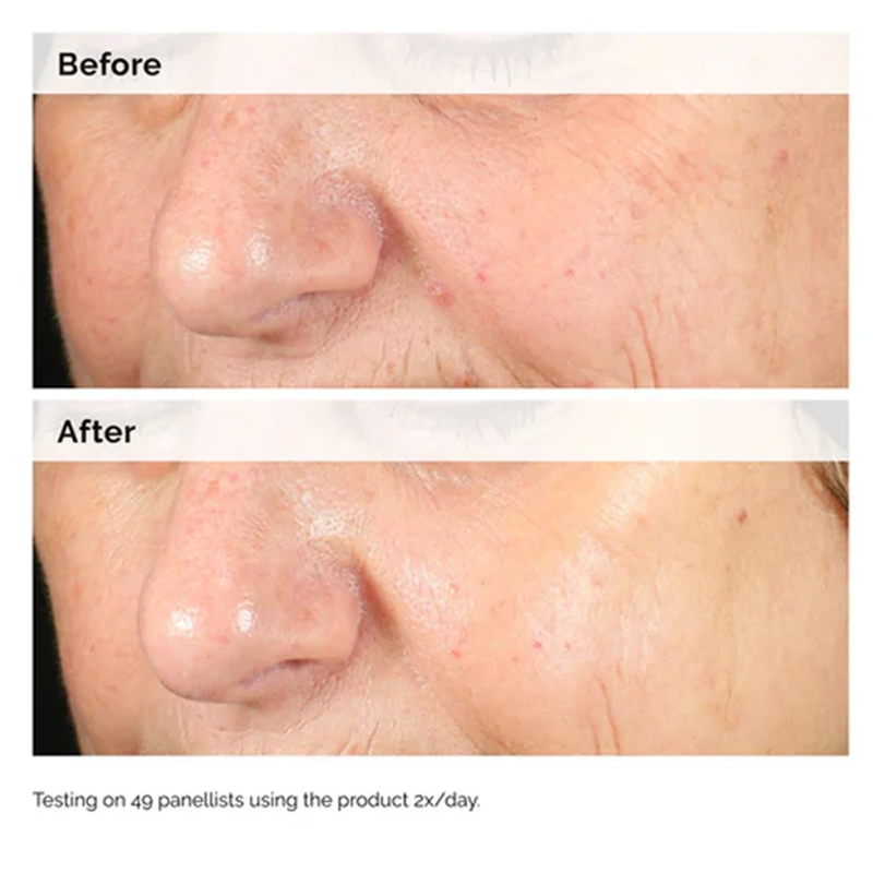 Alpha Arbutin 2% + HA 30ml Ser - огляд і ціна Alpha Arbutin Serum