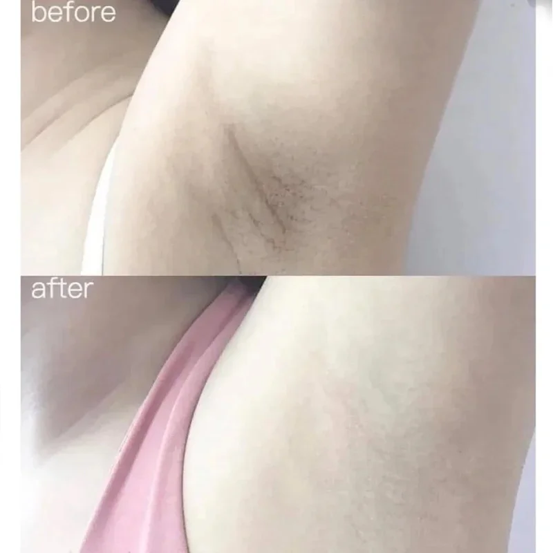 100ml Alpha Arbutin Collagen W - огляд і ціна Alpha Arbutin Serum