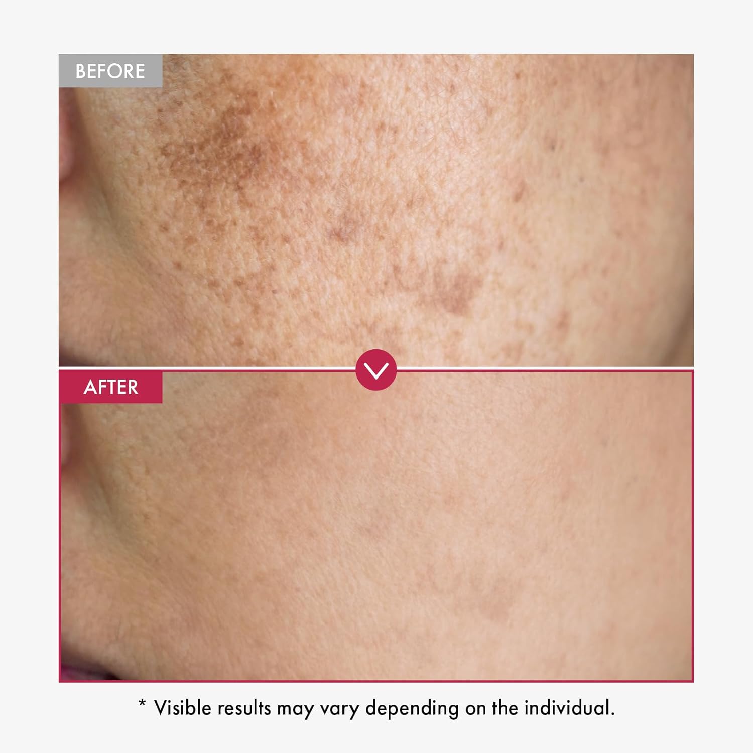 Alpha Arbutin Serum AHA Keeps  - огляд і ціна Alpha Arbutin Serum