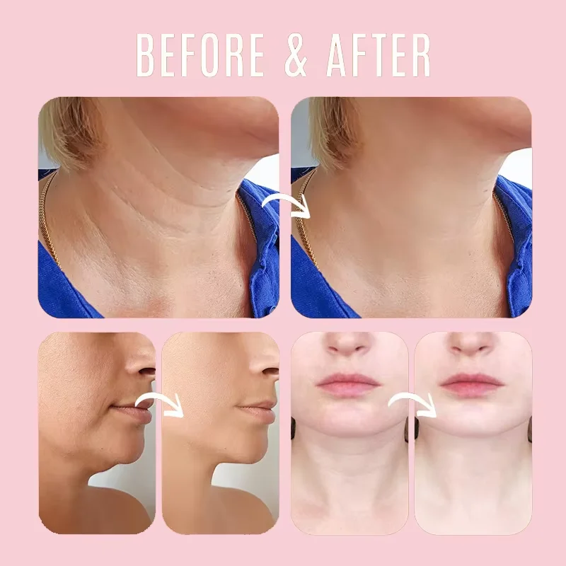 Collagen Wrinkle Removal Multi - огляд і ціна Skincare Collagen